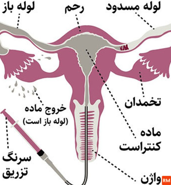 فیلمی از عکس رنگی رحم